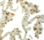 TM4SF1 Antibody in Immunohistochemistry (IHC)