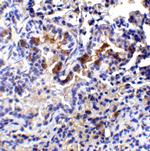 TM4SF1 Antibody in Immunohistochemistry (IHC)