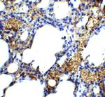 TM4SF1 Antibody in Immunohistochemistry (IHC)