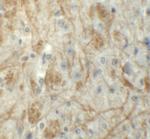 ZNF219 Polyclonal Antibody