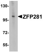 ZNF281 Antibody in Western Blot (WB)