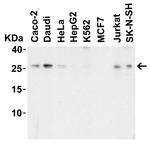 LIF Antibody in Western Blot (WB)
