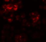 DYRK2 Antibody in Immunocytochemistry (ICC/IF)