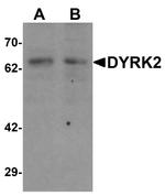 DYRK2 Antibody in Western Blot (WB)