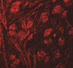 PRR5 Antibody in Immunohistochemistry (IHC)