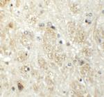 PRR5 Polyclonal Antibody