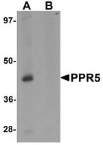 PRR5 Antibody in Western Blot (WB)
