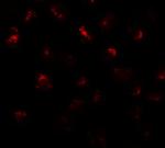 PRR5L Antibody in Immunocytochemistry (ICC/IF)