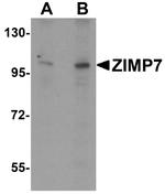 ZMIZ2 Polyclonal Antibody