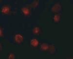 ZMIZ1 Antibody in Immunocytochemistry (ICC/IF)