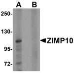 ZMIZ1 Antibody in Western Blot (WB)