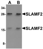 CD48 Polyclonal Antibody