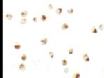 CD229 Antibody in Immunocytochemistry (ICC/IF)