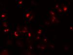 CD229 Antibody in Immunocytochemistry (ICC/IF)