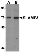 CD229 Antibody in Western Blot (WB)