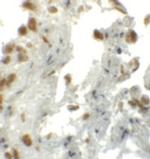 EZH1 Polyclonal Antibody