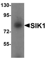 SIK1 Antibody in Western Blot (WB)