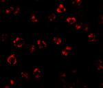 SPTLC2 Antibody in Immunocytochemistry (ICC/IF)