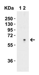 SPTLC2 Antibody in Western Blot (WB)