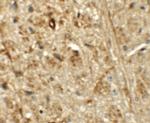 ORMDL1 Polyclonal Antibody