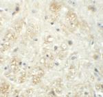 VASH1 Polyclonal Antibody