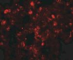 TSN Antibody in Immunohistochemistry (IHC)