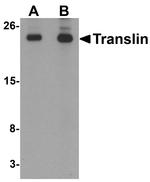 TSN Antibody in Western Blot (WB)