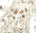 RASSF10 Polyclonal Antibody