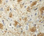 LCMT2 Polyclonal Antibody