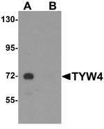 LCMT2 Antibody in Western Blot (WB)