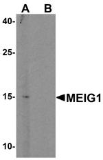 MEIG1 Antibody in Western Blot (WB)