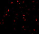 ATAD3A Antibody in Immunocytochemistry (ICC/IF)
