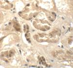 ATAD3B Polyclonal Antibody