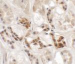 AP3S1 Polyclonal Antibody