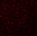 AP3M1 Antibody in Immunohistochemistry (IHC)