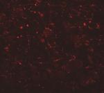 AP3B2 Antibody in Immunohistochemistry (IHC)