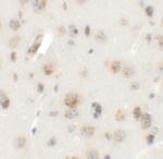 AP3B2 Polyclonal Antibody