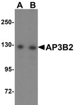 AP3B2 Antibody in Western Blot (WB)