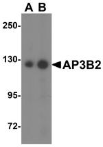 AP3B2 Antibody in Western Blot (WB)