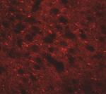 TMEM88 Antibody in Immunohistochemistry (IHC)