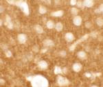 TMEM88 Polyclonal Antibody