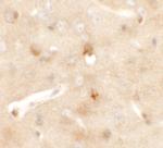 CCDC141 Polyclonal Antibody