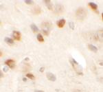 SPRYD2 Polyclonal Antibody