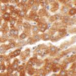 HDGFRP2 Polyclonal Antibody