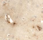 TMEM204 Polyclonal Antibody