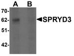 SPRYD3 Antibody in Western Blot (WB)