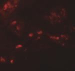 SPRYD4 Antibody in Immunohistochemistry (IHC)