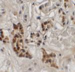 SPRYD4 Polyclonal Antibody