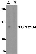 SPRYD4 Antibody in Western Blot (WB)
