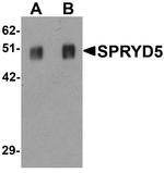 SPRYD5 Antibody in Western Blot (WB)